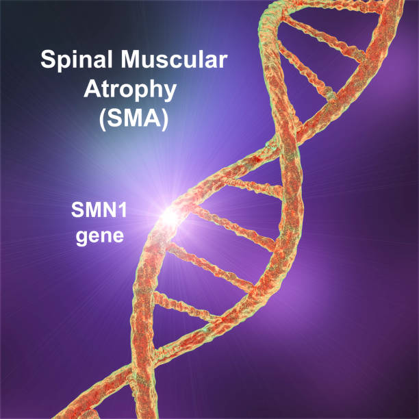 Spinal Amyotrophy: Understanding the Rare Genetic Disorder