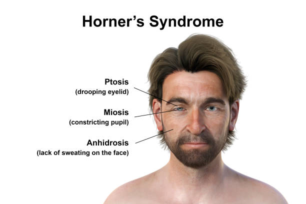 Understanding Herpes: Symptoms, Transmission, and Natural Management Strategies