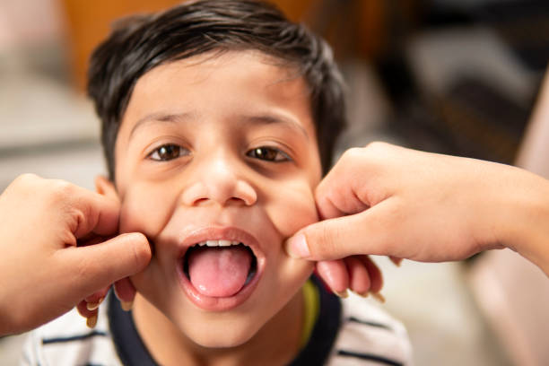 What is Tongue Thrust in Children? Causes, Symptoms, and Treatment